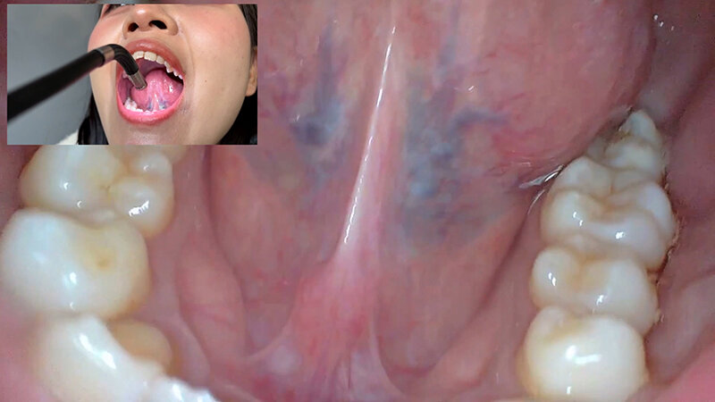 「【素人ナンパ】コールセンター勤務の美人お姉さんに街角で声かけ！口内観察に恥じらう姿が可愛すぎる」のサンプル画像15枚目