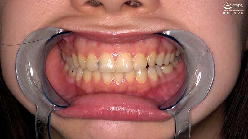 「【甘井くるみ】口内観察・歯・のどちんこ接写&咀嚼プレイ【フェチ動画】貴重映像で魅せる巨大女の世界」のサンプル画像4枚目