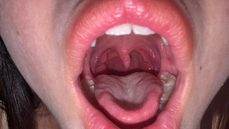 「【七藤優亜】超長舌お姉さんの開口器観察プレイ｜素人個人撮影で魅せる濃厚舌技」のサンプル画像5枚目