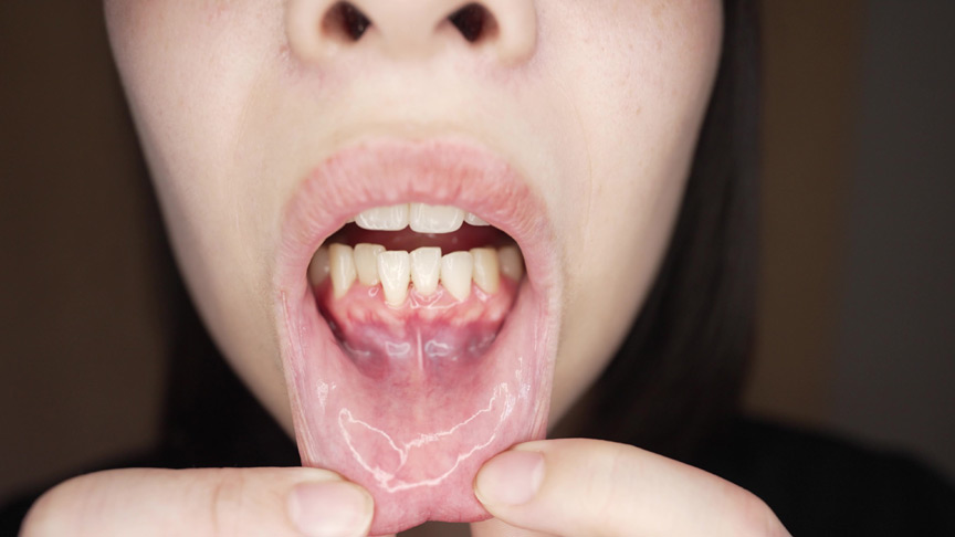 「【湊波流】【口腔フェチ】歯と舌の接写観察プレイ｜変態紳士の匂いチェック動画【マニアック】」のサンプル画像3枚目