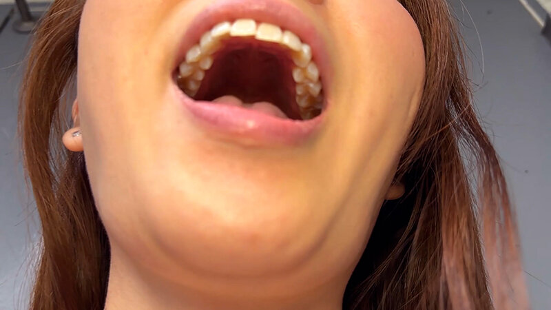 「【素人ナンパ】商社営業のお姉さんれなちゃんに街角で声かけ口内観察に挑戦」のサンプル画像17枚目