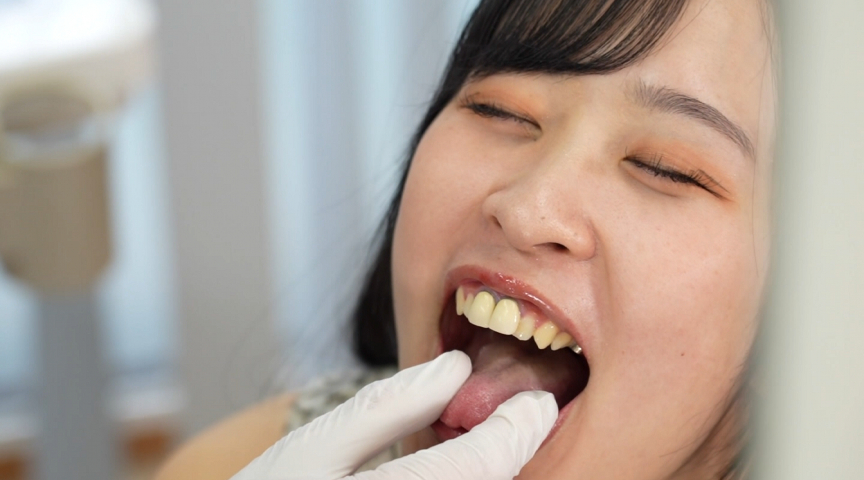 「朝比ゆの｜保育士コスプレで口内観察フェチプレイ｜舌・歯をじっくり見せる接写動画」のサムネイル