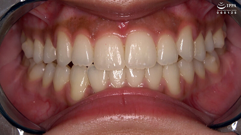 「【加護まり】口内・歯・のどちんこ観察＆咀嚼プレイ【フェチ動画】激レア巨大女作品」のサンプル画像3枚目