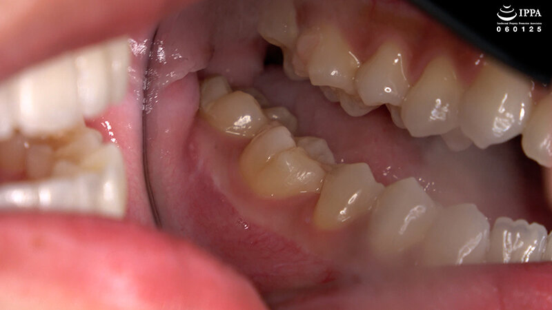 「【加護まり】口内・歯・のどちんこ観察＆咀嚼プレイ【フェチ動画】激レア巨大女作品」のサンプル画像4枚目