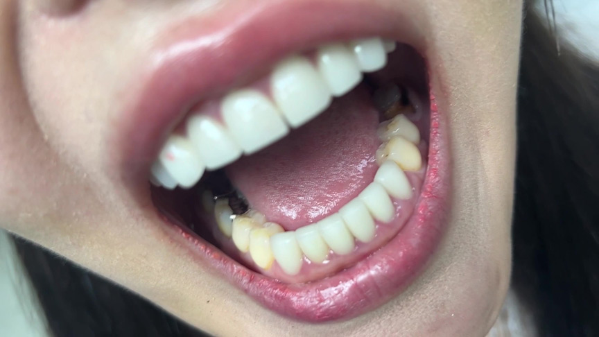 「【素人8名】口腔観察フェチ動画【歯・舌・喉チェック】150分大容量お得セット」のサンプル画像4枚目