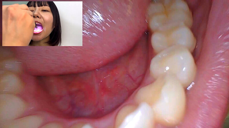 「【素人ナンパ】街角お姉さんみゆりちゃんの口内観察!テレビ局AD美女が恥じらい体験」のサンプル画像14枚目