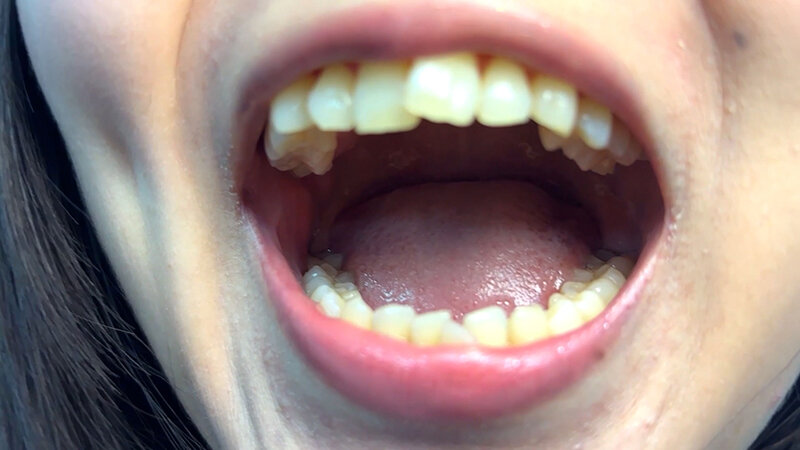 「【素人ナンパ】街角お姉さんみゆりちゃんの口内観察!テレビ局AD美女が恥じらい体験」のサンプル画像2枚目